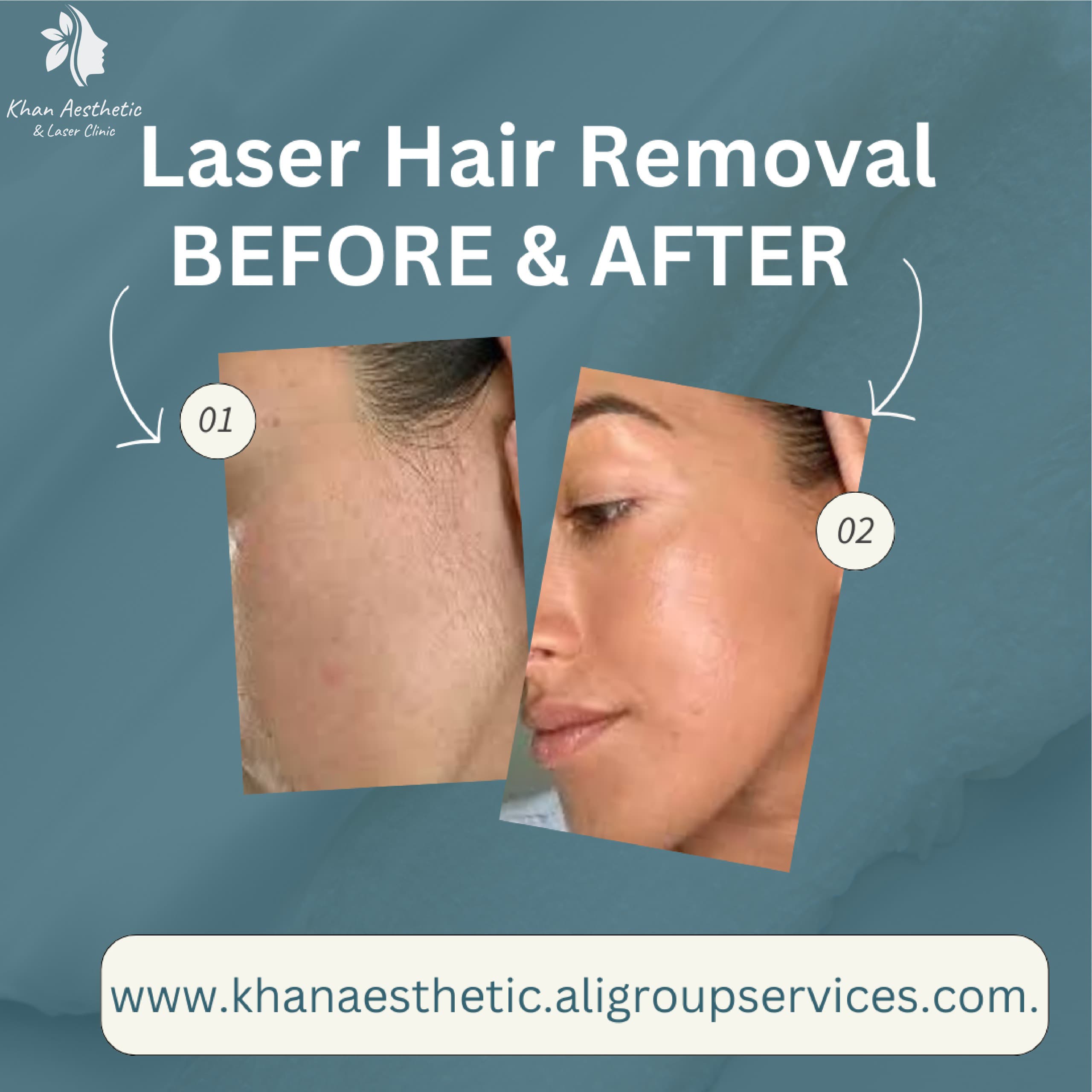 hydra Facial in Multan
