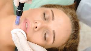 Collagen induction therapy