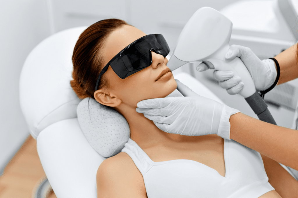 Upper-Lip-Laser-Hair-Removal